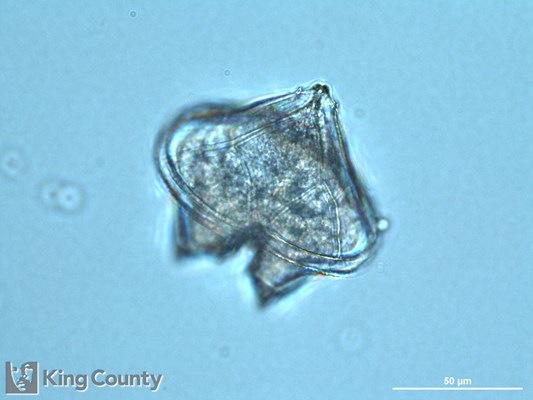 Photo of Protoperidinium conicum/Protoperidinium leonis